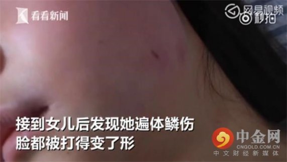 關注校園暴力：初二女生被同學暴打拍裸照，父母報警三次